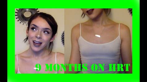 teenage tits|Normal Breast Development and Changes